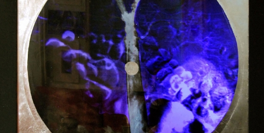 Pièce n°3, imagerie médicale et or, rétro-éclairée 85 x 85 cm, 2012